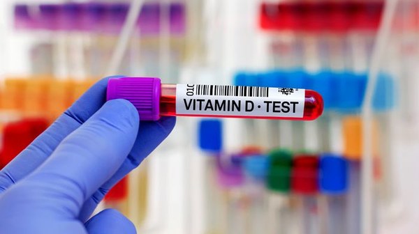 Kedy je potrebný test vitamínu D?